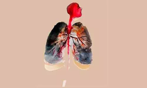 ജമിനി ഗണേശനും  ആദിവാസി രോഗങ്ങളും