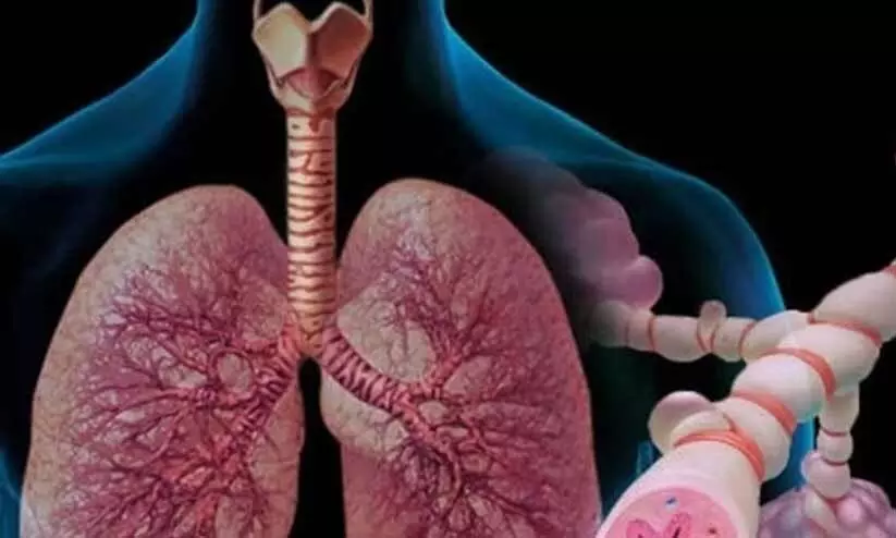 കോവിഡാനന്തരമുള്ള ശ്വാസകോശ പ്രശ്നങ്ങൾ ഏറ്റവും കൂടുതൽ ഇന്ത്യക്കാരിലെന്ന് പഠനം