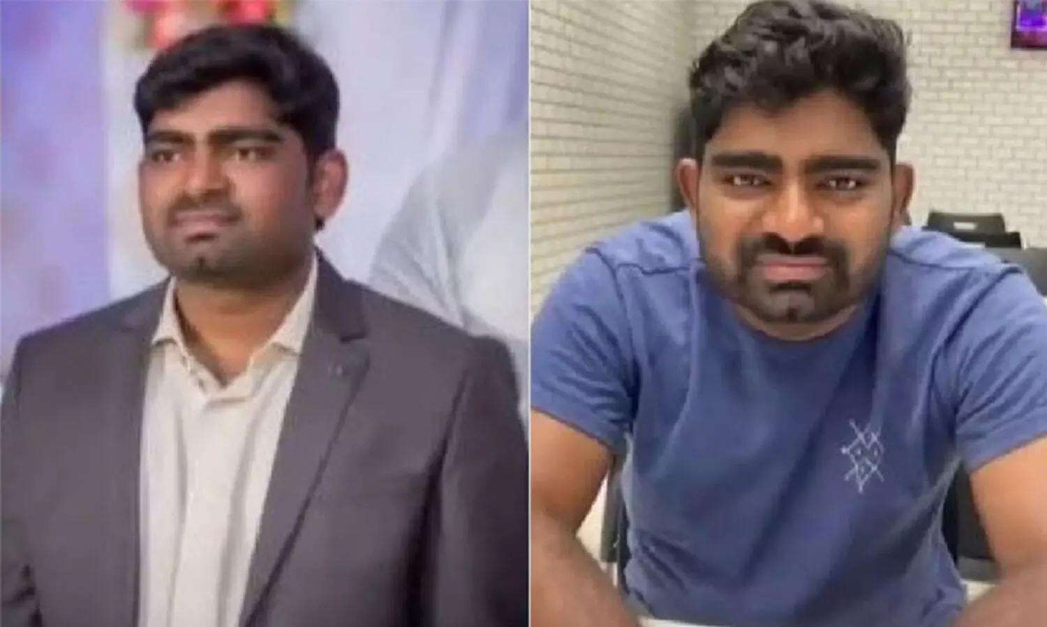 ചിരി നന്നാക്കാനുള്ള ശസ്ത്രക്രിയക്കിടെ പ്രതിശ്രുത വരൻ മരിച്ചു; മരണകാരണം അനസ്തേഷ്യയിലെ പിഴവെന്ന് പിതാവ്