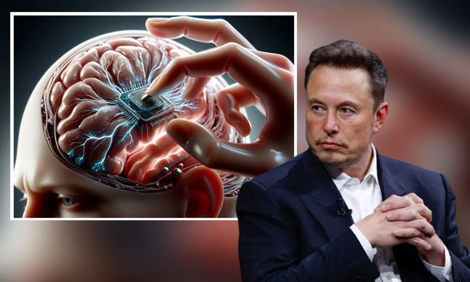 ആദ്യമായി ബ്രെയിൻ ചിപ്പ് ഘടിപ്പിച്ച മനുഷ്യന് എന്ത് സംഭവിച്ചു..? പ്രതികരിച്ച് ഇലോൺ മസ്ക്