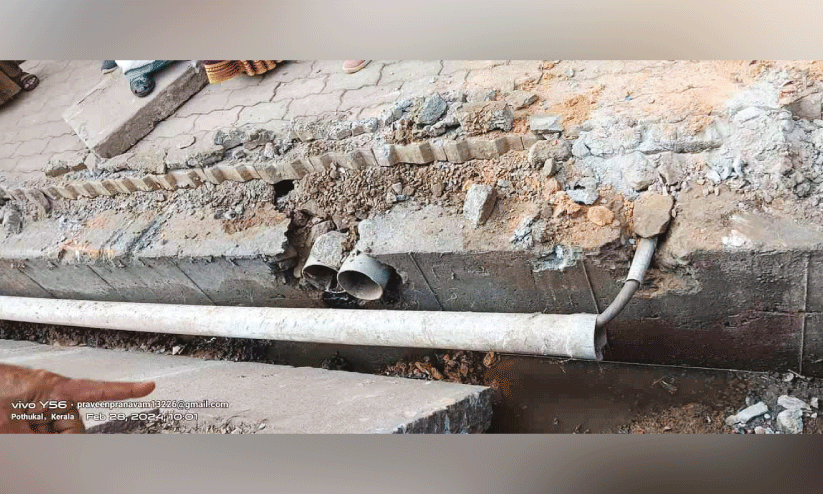 jaundice prevention jaundice prevention