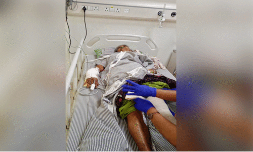 പട്ടാപ്പകൽ കാട്ടുപന്നി ആക്രമണം; റിട്ട. അധ്യാപികക്ക് ഗുരുതര പരിക്ക്