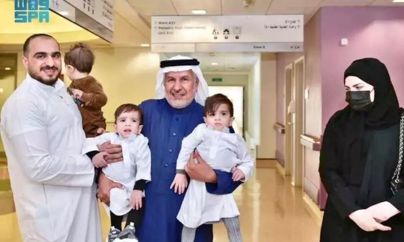 Dr.Abdullah Al-Rabia visited separated Siamese twins