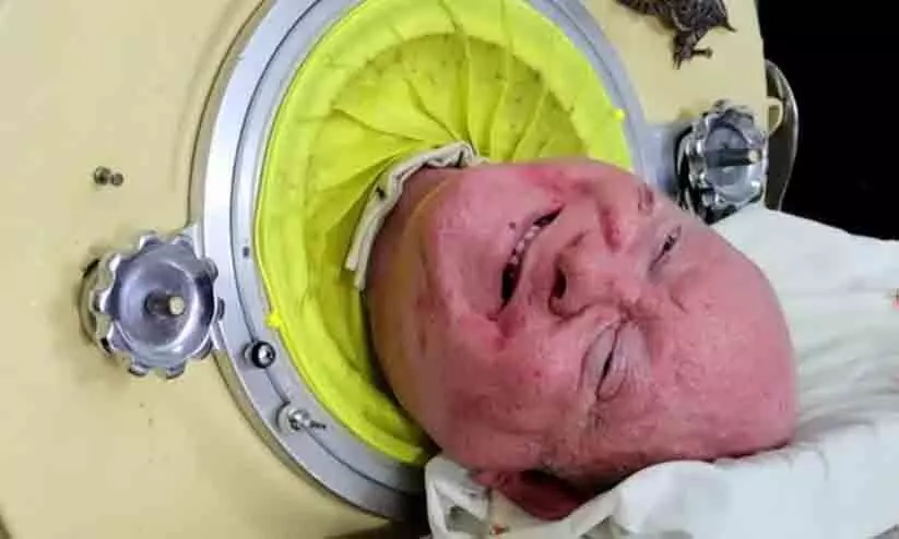 Paul Alexander Paul Alexander