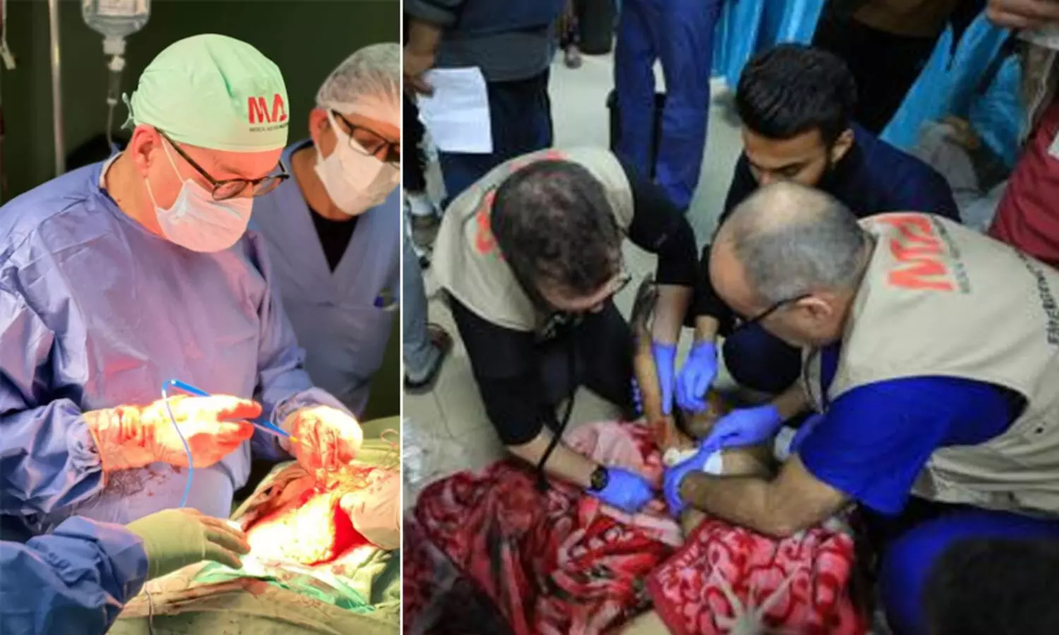 ‘കുഞ്ഞുമുഖം പൊള്ളി അസ്ഥികൾ പുറത്തായി, മരണാസന്നയായ അവളെ കിടത്താൻ പോലും ഇടമില്ലായിരുന്നു’ -ഗസ്സയിലെ ഞെട്ടിക്കുന്ന അനുഭവങ്ങൾ പങ്കു​​​വെച്ച് ബ്രിട്ടീഷ് ഡോക്ടർ