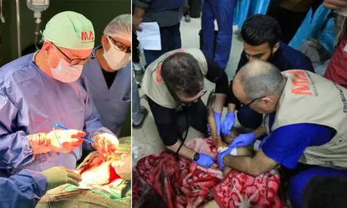 ‘കുഞ്ഞുമുഖം പൊള്ളി അസ്ഥികൾ പുറത്തായി, മരണാസന്നയായ അവളെ കിടത്താൻ പോലും ഇടമില്ലായിരുന്നു’ -ഗസ്സയിലെ ഞെട്ടിക്കുന്ന അനുഭവങ്ങൾ പങ്കു​​​വെച്ച് ബ്രിട്ടീഷ് ഡോക്ടർ