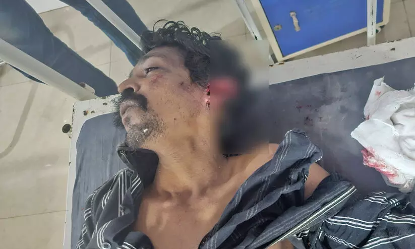 നായുടെ കടിയേറ്റ നിലയിൽ കണ്ടെത്തിയയാൾ മരിച്ചു