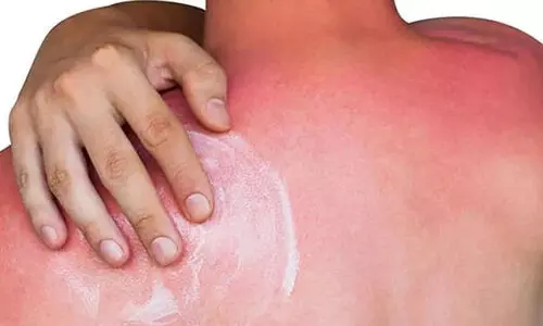 മലപ്പുറത്ത് വീട്ടുവളപ്പില്‍ ജോലി ചെയ്യുന്നതിനിടെ യുവാവിന് സൂര്യാഘാതമേറ്റു