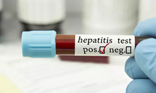 hepatitis