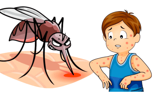 Heat illnesses Heat illnesses