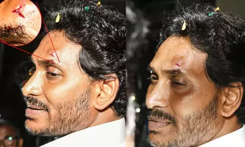 ആന്ധ്ര മുഖ്യമന്ത്രി ജഗൻ മോഹൻ റെഡ്ഡിക്ക് കല്ലേറിൽ പരിക്ക്