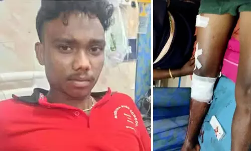 വാൽപ്പാറയിൽ ചീങ്കണ്ണി ആക്രമണത്തിൽ 17കാരന് പരിക്ക്