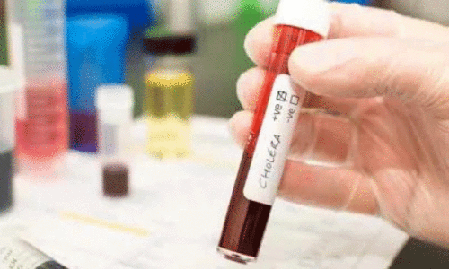 representation image