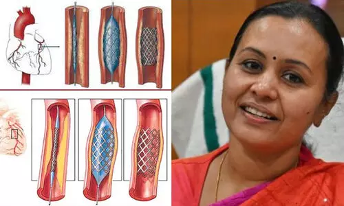 സ്റ്റെന്റിന് കുറവ് വന്നാല്‍ പരിഹരിക്കാന്‍ നടപടിയെന്ന് വീണ ജോര്‍ജ്