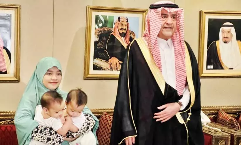 Filipino Siamese Twins with the Saudi Ambassador