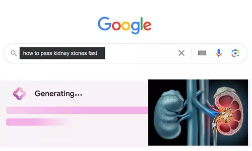 കിഡ്നിയിലെ കല്ല് മാറാൻ 2 ലിറ്റർ മൂത്രം കുടിക്കാൻ ഉപദേശിച്ച് ഗൂഗിൾ എ.ഐ; വിവാദം