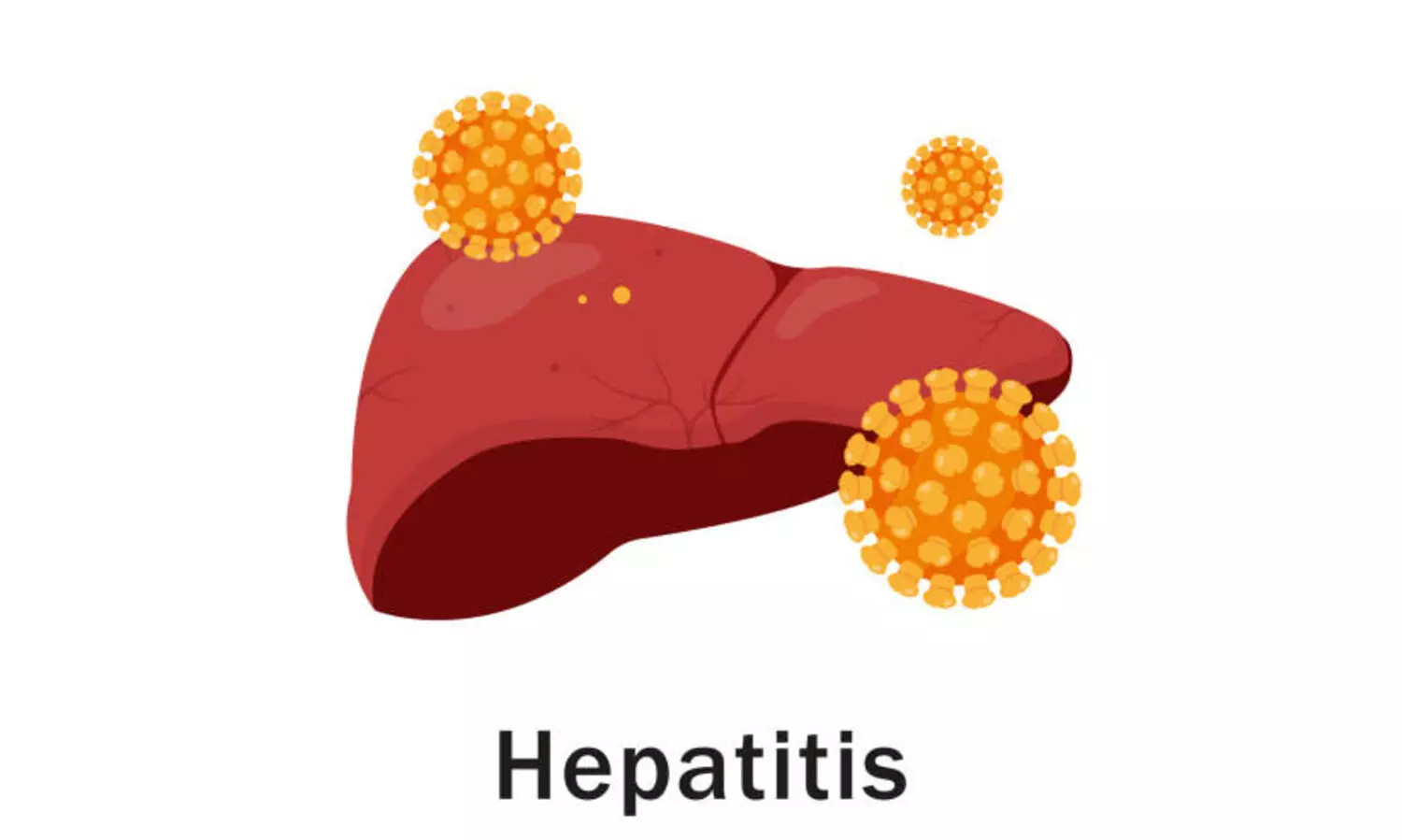 Viral Hepatitis