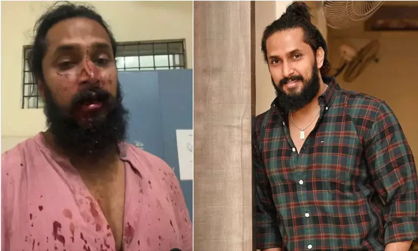 കന്നഡ നടൻ ചേതൻ ചന്ദ്രക്ക് നേരെ ആൾക്കൂട്ട ആക്രമണം