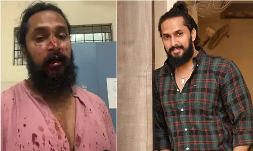 കന്നഡ നടൻ ചേതൻ ചന്ദ്രക്ക് നേരെ ആൾക്കൂട്ട ആക്രമണം