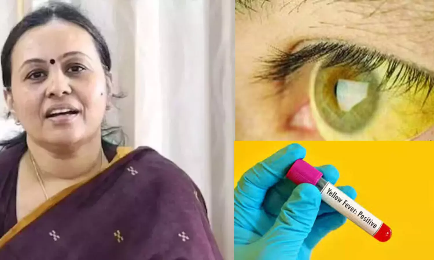 മഞ്ഞപ്പിത്ത ജാഗ്രത, തിളപ്പിച്ചാറ്റിയ വെള്ളം മാത്രമേ കുടിക്കാവൂയെന്ന് വീണ ജോര്‍ജ്