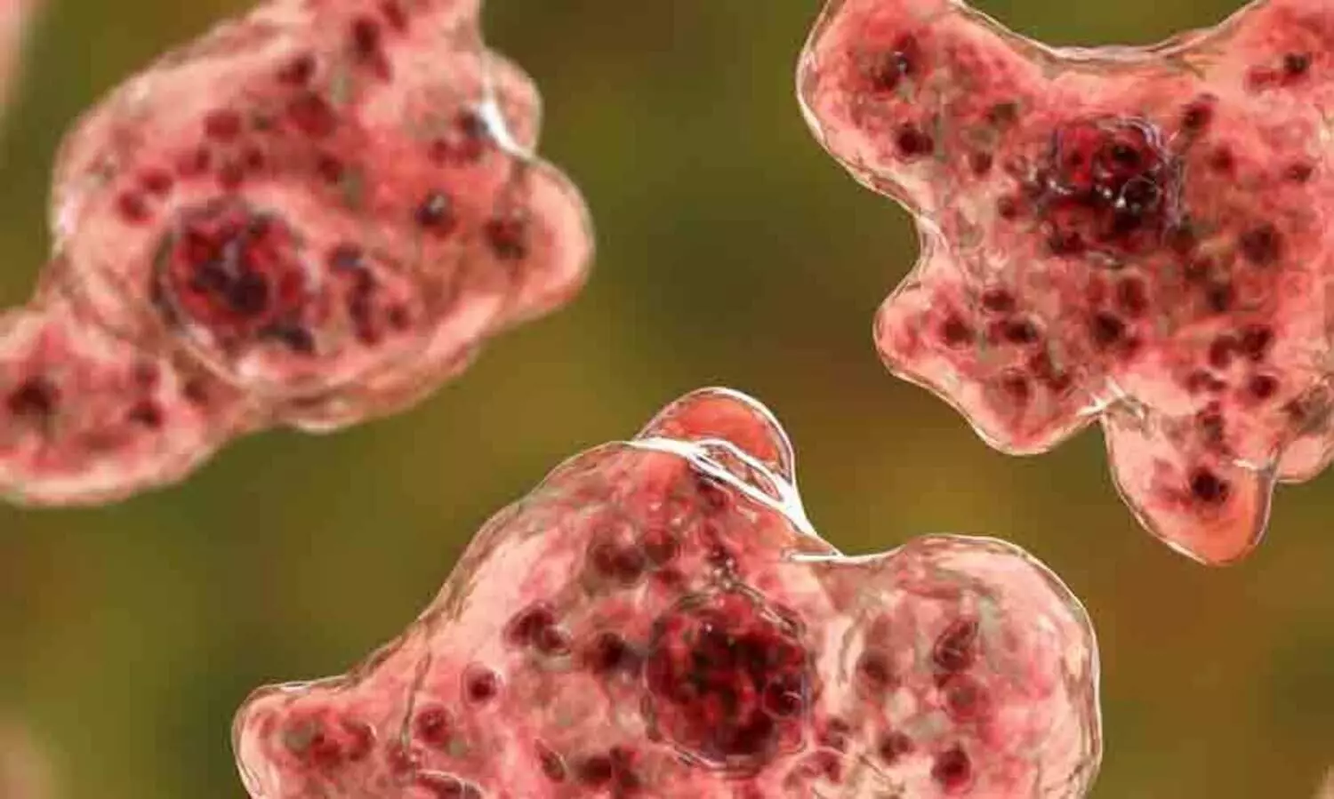 അമീബിക് മസ്തിഷ്‍ക ജ്വരം ബാധിച്ച് അഞ്ചു വയസ്സുകാരി ഗുരുതരാവസ്ഥയിൽ