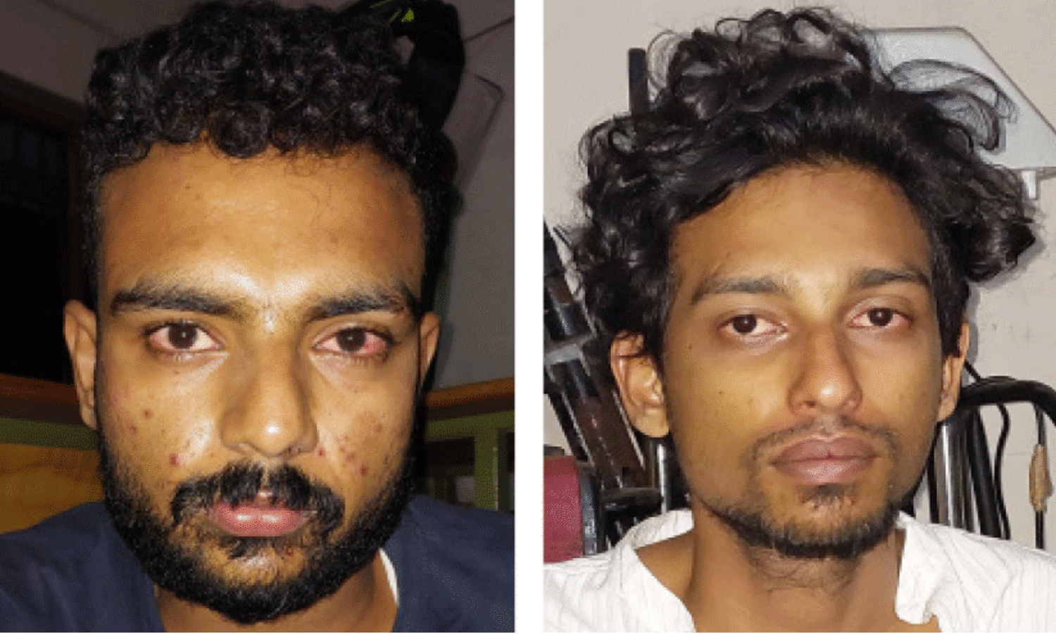 Drugs are flowing in the district