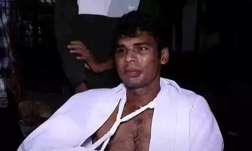 രോഗിക്ക് കമ്പി മാറിയിട്ട സംഭവം: പിഴവ് സംഭവിച്ചി​ട്ടില്ലെന്ന് കോഴിക്കോട് മെഡിക്കൽ കോളജ്