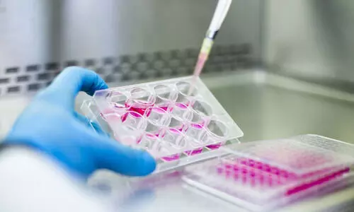 ഒ​ട്ട​ക ഭ്രൂ​ണ​ത്തി​ല്‍നി​ന്ന് കോ​ശം വേ​ര്‍തി​രി​ക്ക​ൽ: നി​ർ​ണാ​യ​ക നേ​ട്ട​വു​മാ​യി ശാ​സ്ത്ര​ജ്ഞ​ർ