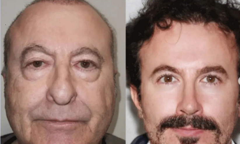 മിഖായീൽ സർജറിക്കുമുമ്പും ശേഷവും മിഖായീൽ സർജറിക്കുമുമ്പും ശേഷവും