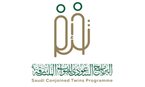 Separated Siamese Twins