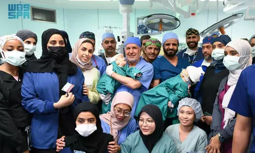 അകിസയും ആ​ഇശയും ഇനി ​രണ്ട്​; സൗദിയിൽ സയാമീസ്​ ഇരട്ടകളുടെ വേർപെടുത്തൽ വിജയകരം