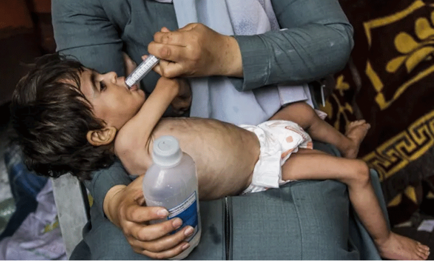 ഗസ്സയിൽ വിശന്നുകരയുന്നത് 8000 കുഞ്ഞുങ്ങൾ