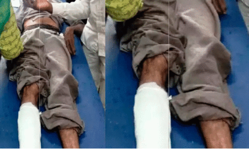 ഹാ​സ​നി​ൽ കാ​ട്ടാ​ന​യു​ടെ ആ​ക്ര​മ​ണ​ത്തി​ൽ തൊ​ഴി​ലാ​ളി​ക്ക് പ​രി​ക്ക്