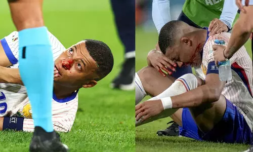 എംബാപ്പെയുടെ പരിക്ക് ഗുരുതരമല്ലെന്ന് റിപ്പോർട്ട്; പ്രത്യേക മാസ്കണിഞ്ഞ് കളിക്കും