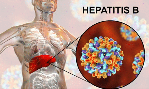 hepatitis b