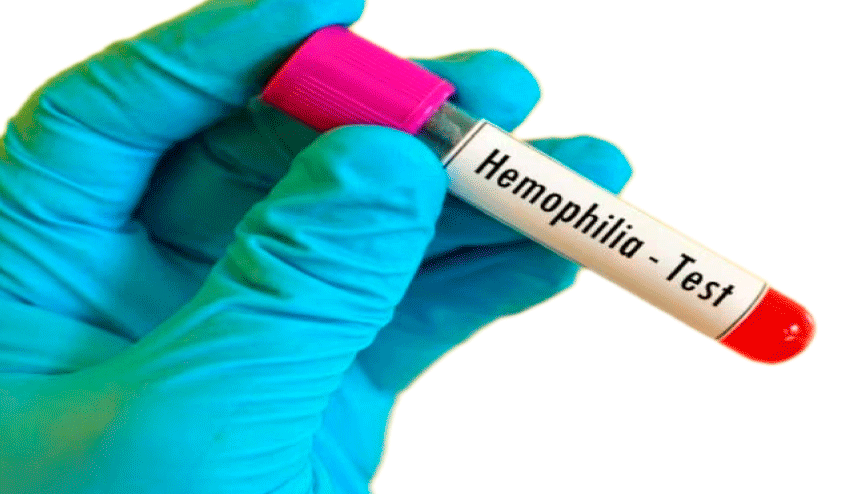 Hemophilia Hemophilia