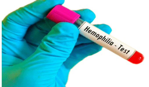 Hemophilia