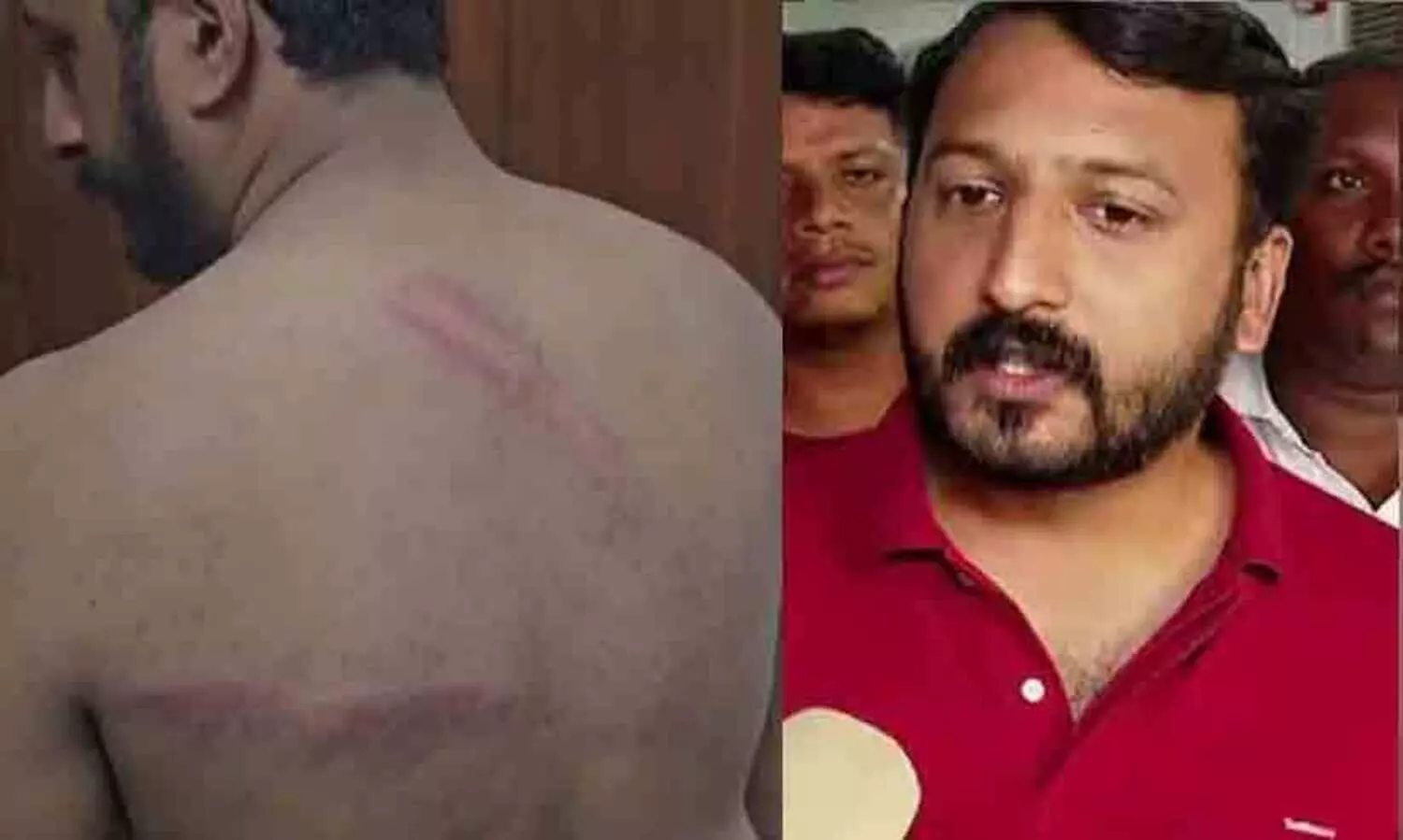 ഡൽഹിയിൽ യൂത്ത് കോൺഗ്രസ് മാർച്ചിൽ സംഘർഷം; രാഹുൽ മാങ്കൂട്ടത്തിലിന് ലാത്തിച്ചാർജിൽ  പരിക്ക്