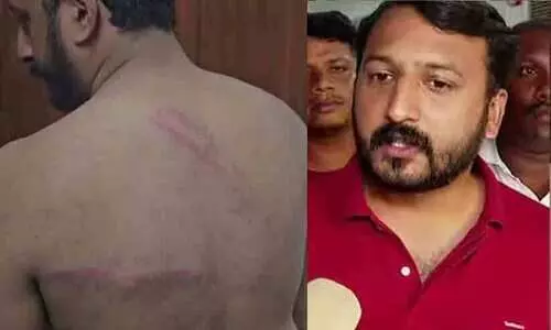 ഡൽഹിയിൽ യൂത്ത് കോൺഗ്രസ് മാർച്ചിൽ സംഘർഷം; രാഹുൽ മാങ്കൂട്ടത്തിലിന് ലാത്തിച്ചാർജിൽ പരിക്ക് ഡൽഹിയിൽ യൂത്ത് കോൺഗ്രസ് മാർച്ചിൽ സംഘർഷം; രാഹുൽ മാങ്കൂട്ടത്തിലിന് ലാത്തിച്ചാർജിൽ പരിക്ക്