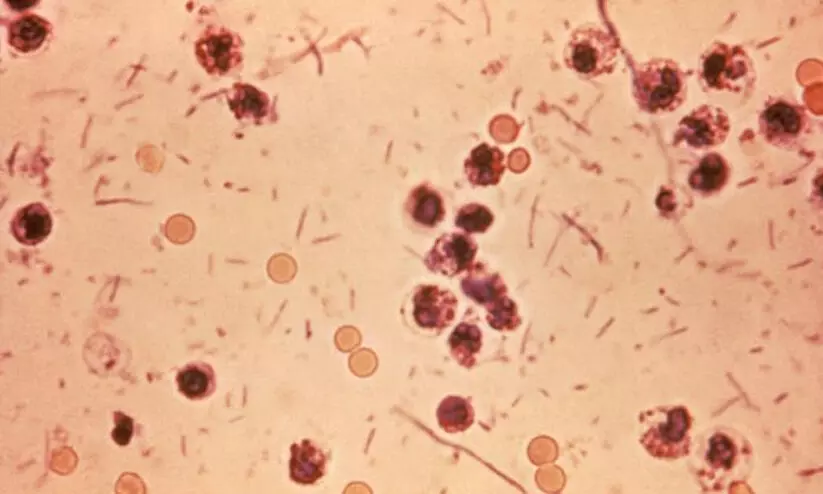 മലപ്പുറത്ത് നാലു കുട്ടികള്‍ക്ക് ഷിഗെല്ല സ്ഥിരീകരിച്ചു