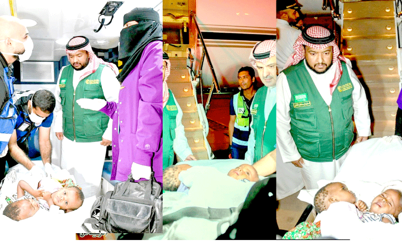 Burkinabe Siamese twins arrive in Riyadh