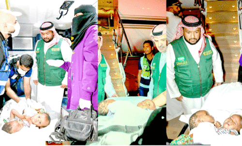 Burkinabe Siamese twins arrive in Riyadh