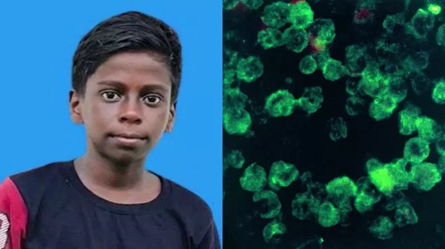 കോഴിക്കോട് അമീബിക് മെനിഞ്ചൈറ്റിസ് ബാധിച്ച കുട്ടി മരിച്ചു കോഴിക്കോട് അമീബിക് മെനിഞ്ചൈറ്റിസ് ബാധിച്ച കുട്ടി മരിച്ചു