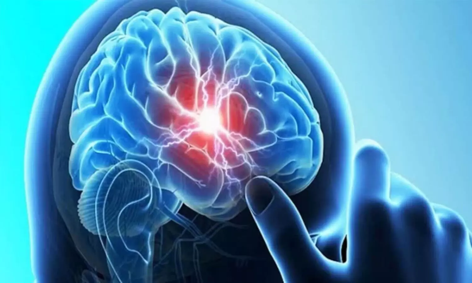 amoebic encephalitis