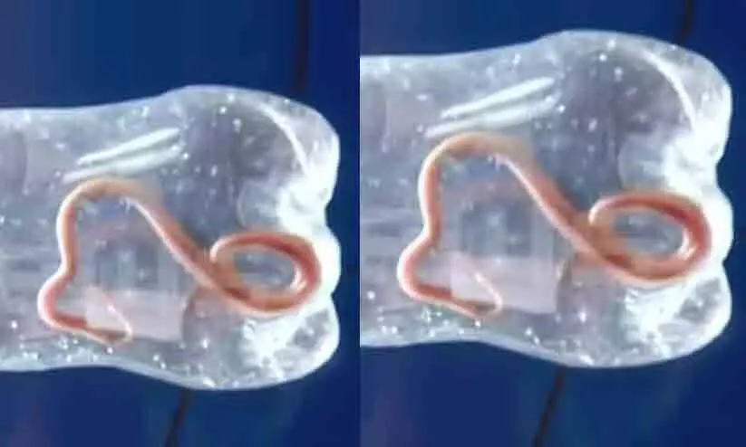 എട്ടുമാസം പ്രായമുള്ള പനി ബാധിച്ച മകളെയും കൊണ്ട് ആശുപത്രിയിലെത്തിയ യുവതിക്ക് പാമ്പുകടിയേറ്റു