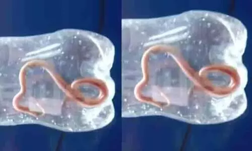 എട്ടുമാസം പ്രായമുള്ള പനി ബാധിച്ച മകളെയും കൊണ്ട് ആശുപത്രിയിലെത്തിയ യുവതിക്ക് പാമ്പുകടിയേറ്റു