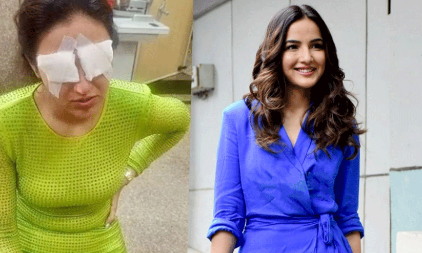 കോൺടാക്ട് ലെൻസ് ഉപയോഗിച്ച് കണ്ണിന് പരിക്കേറ്റു; വേദന കാരണം ഉറങ്ങാൻ കഴിയുന്നില്ലെന്ന് താരം കോൺടാക്ട് ലെൻസ് ഉപയോഗിച്ച് കണ്ണിന് പരിക്കേറ്റു; വേദന കാരണം ഉറങ്ങാൻ കഴിയുന്നില്ലെന്ന് താരം