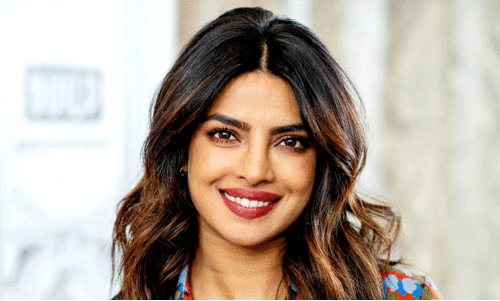 Priyanka Chopra Jonas was once slapped by a monkey!