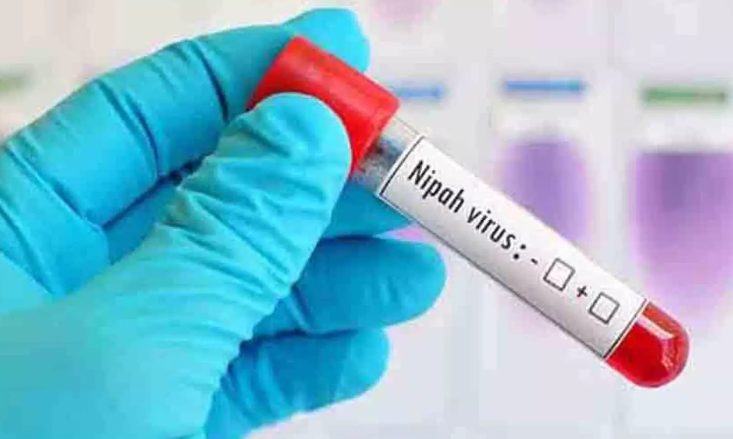 നിപയിൽ ആശ്വാസം; മൂന്നാം ദിവസവും ഫലങ്ങൾ നെഗറ്റീവ്