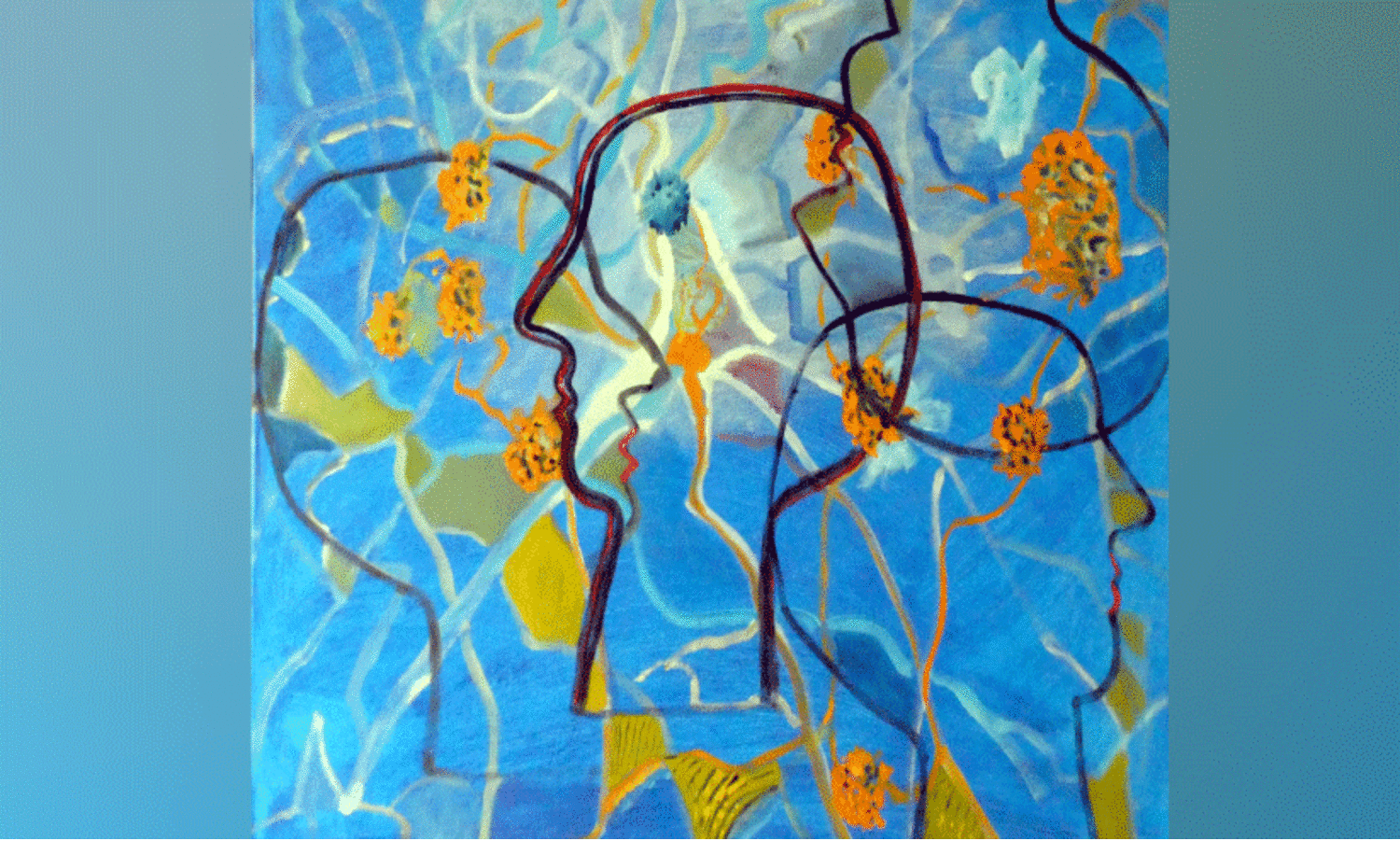 അൽഷിമേഴ്‌സ്